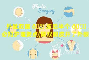 外眦双眼 🦆 皮后半个 🐝 月必知护理要点(做双眼皮开了外眼角怎么才恢复得快)